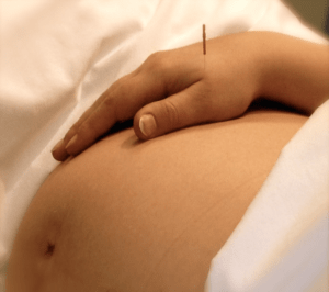 Acupuncture treatment during pregnancy